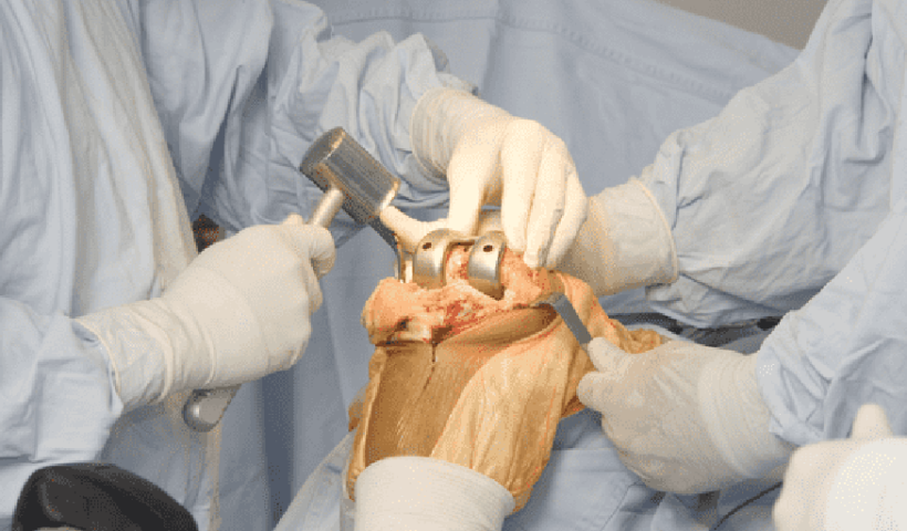 Orthopedic Surgery